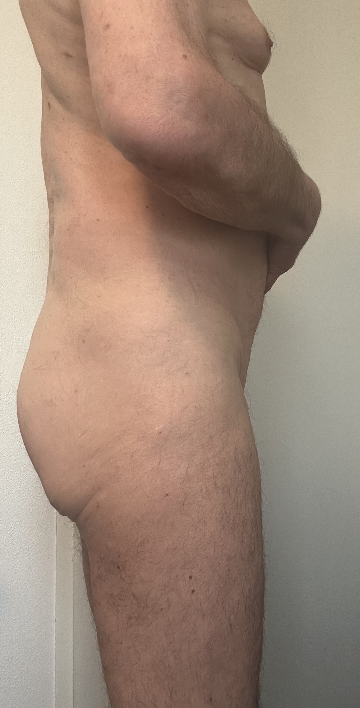B68